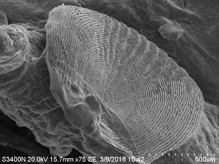 Figure: Scanning Electron Microscope Image of a Brill fish scale